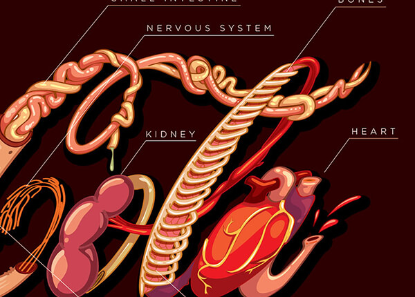 Internal Organs Drawn in the Shape of Coca-Cola Logo Indicates the Harm Caused by Drinking the Soda